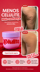Xôlulite - Removedor de Celulite